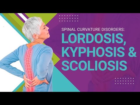 Spinal Curvature Disorders: Lordosis, Kyphosis &amp; Scoliosis