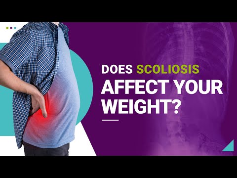 Does Scoliosis Affect Your Weight?