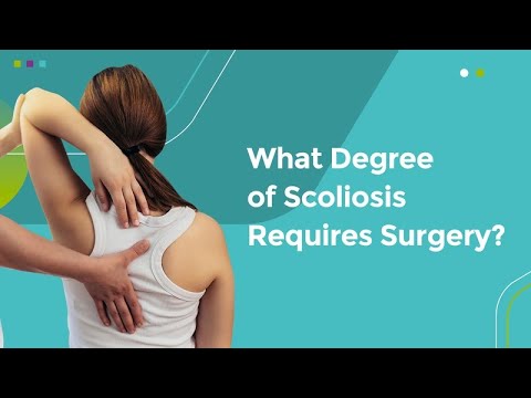 What Degree of Scoliosis Requires Surgery?