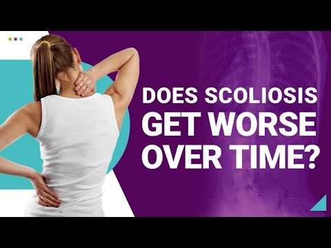 Does Scoliosis Get Worse Over Time?