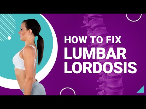How to Fix Lumbar Lordosis
