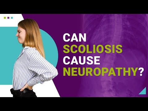 Can Scoliosis Cause Neuropathy?