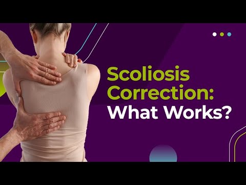 Scoliosis Correction: What Works?