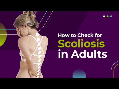How to Check for Scoliosis in Adults