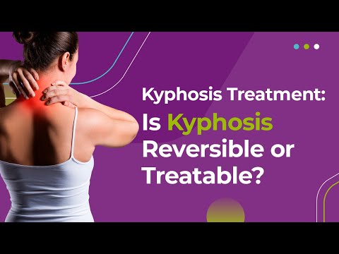 Kyphosis Treatment: Is Kyphosis Reversible or Treatable?