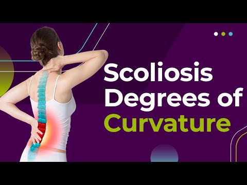 Scoliosis Degrees of Curvature