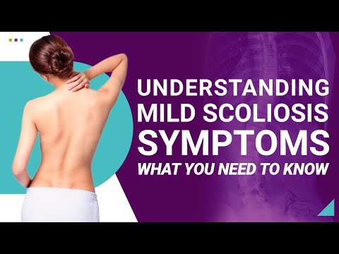 Understanding Mild Scoliosis Symptoms: What You Need to Know