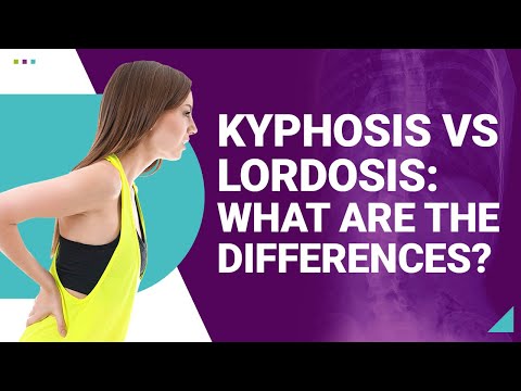Kyphosis vs Lordosis: What are the Differences?