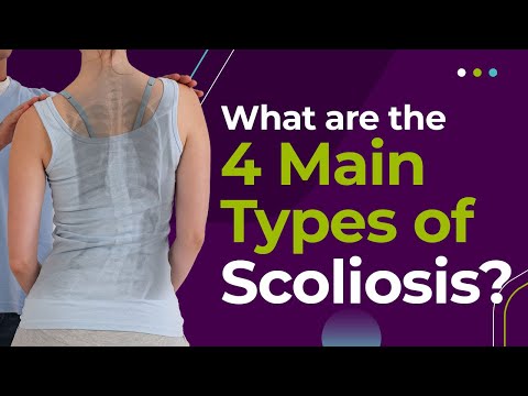 What Are The 4 Main Types of Scoliosis?