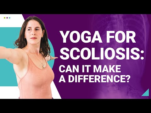 Yoga for Scoliosis, Can It Really Make A Difference?