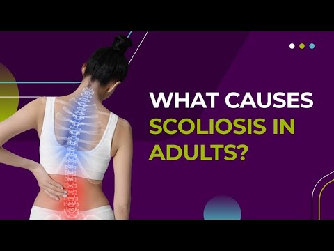 What Causes Scoliosis in Adults?