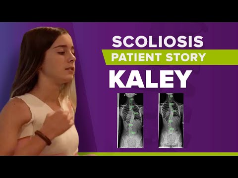 Adolescent Severe Scoliosis Curve Reduction: Kaley&#039;s Story