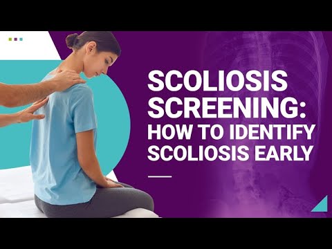 Scoliosis Screening: How to Identify Scoliosis Early