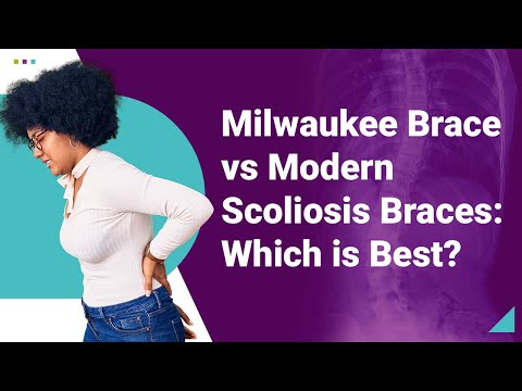 Milwaukee Brace vs Modern Scoliosis Braces: Which is Best?