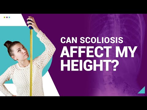 Can Scoliosis Affect My Height?