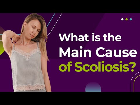 What is the Main Cause of Scoliosis?