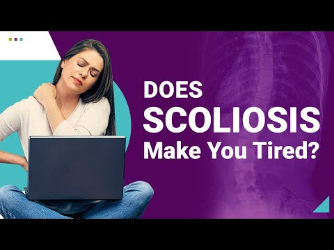 Does Scoliosis Make You Tired? Find Out Here!