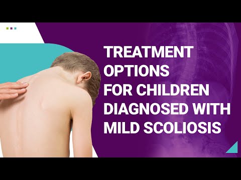 Treatment Options for Children Diagnosed with Mild Scoliosis