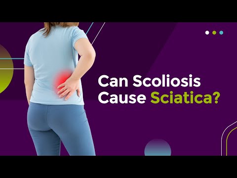 Can Scoliosis Cause Sciatica?