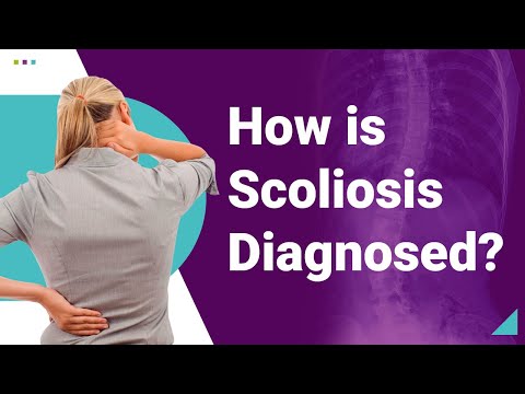 How is Scoliosis Diagnosed?