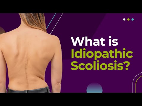 What is Idiopathic Scoliosis?