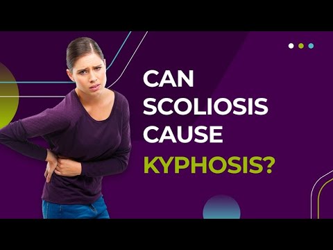 Can Scoliosis Cause Kyphosis?