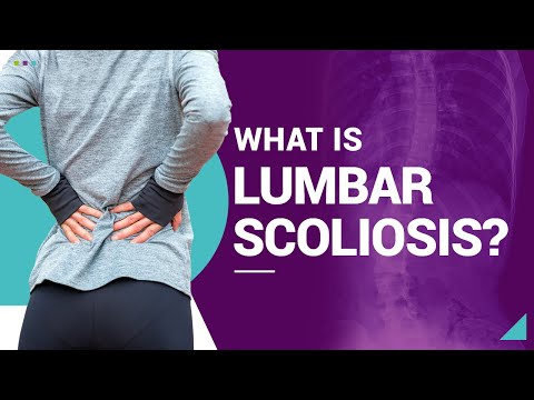 What Is Lumbar Scoliosis?