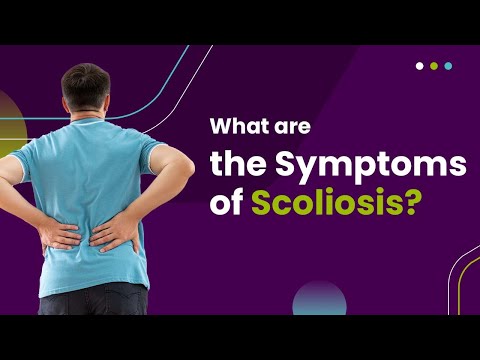 What Are The Symptoms Of Scoliosis?