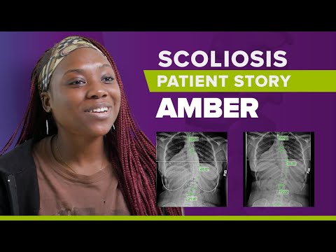 Scoliosis Treatment Without Surgery, Amber&#039;s Story