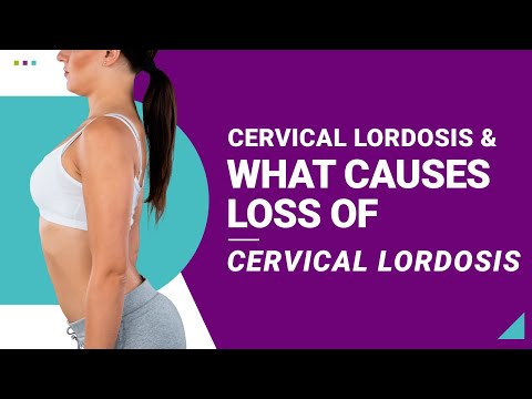 Cervical Lordosis &amp; What Causes Loss of Cervical Lordosis