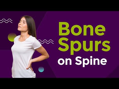 Bone Spurs on Spine