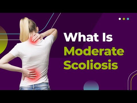 What Is Moderate Scoliosis?