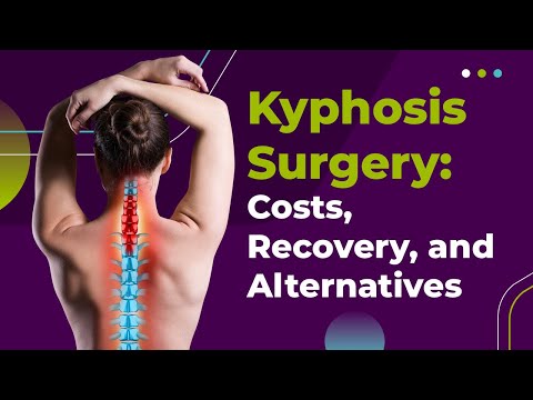 Kyphosis Surgery: Costs, Recovery, and Alternatives
