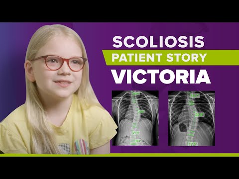 Scoliosis Surgery vs Scoliosis Treatment Without Surgery: Victoria&#039;s Story