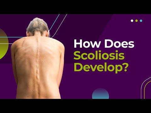 How Does Scoliosis Develop?