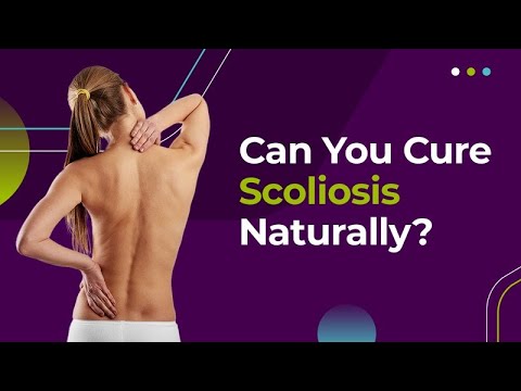 Can You Cure Scoliosis Naturally?