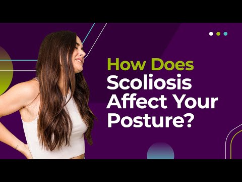 How Does Scoliosis Affect Your Posture?