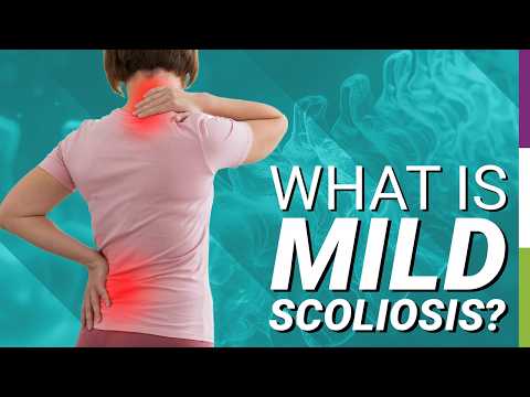 What is Mild Scoliosis?