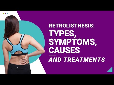 Retrolisthesis: Types, Symptoms, Causes and Treatments