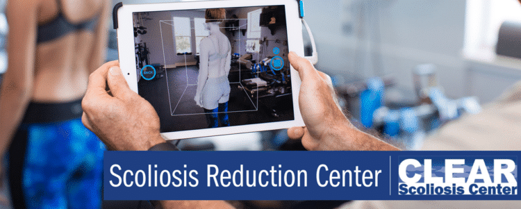 Welcome to the Scoliosis Reduction Center blog!
