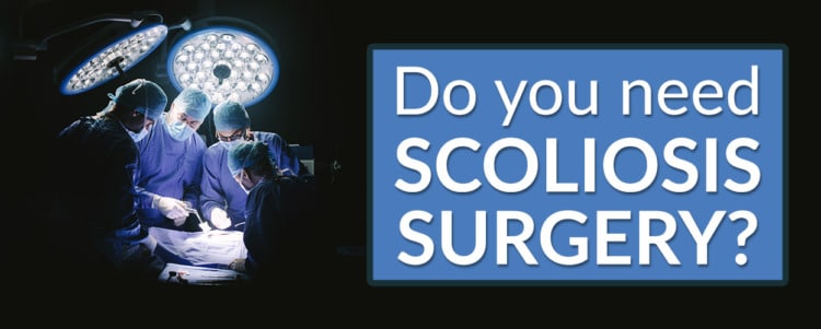 do you need scoliosis surgery