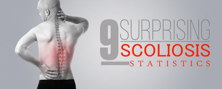 9 Surprising Scoliosis Statistics