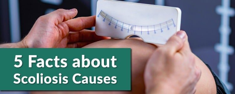 facts about scoliosis causes