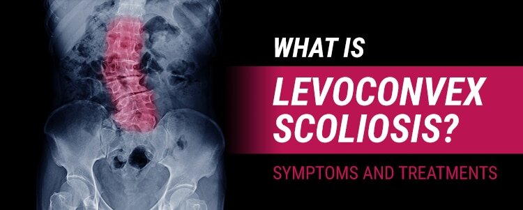 What is Levoconvex Scoliosis? Symptoms and Treatments