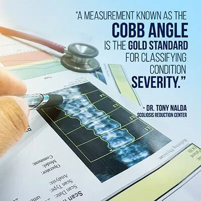 a measurement known small a measurement known small