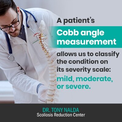 a patients cobb angle measurement