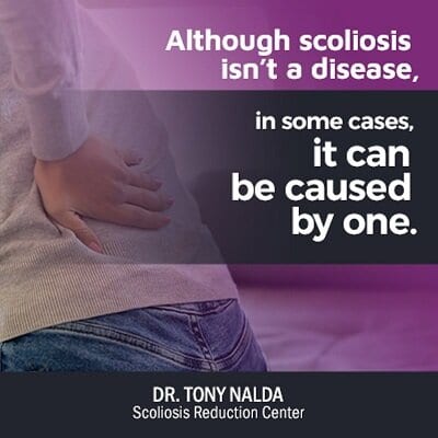 although scoliosis isnt small