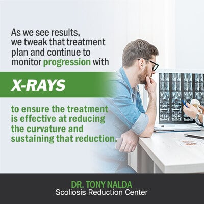 as we see results we tweak that treatment 400 as we see results we tweak that treatment