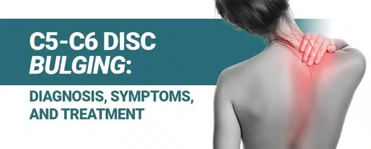 Tutor vogel Waakzaamheid C5-C6 Disc Bulging: Diagnosis, Symptoms, and Treatment