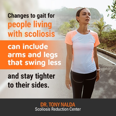 changes to gait for people 400